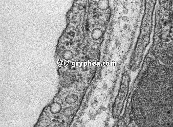 Pinocytose au niveau de l'endothélium d'un capillaire sanguin MET x100000 - gryphea.com